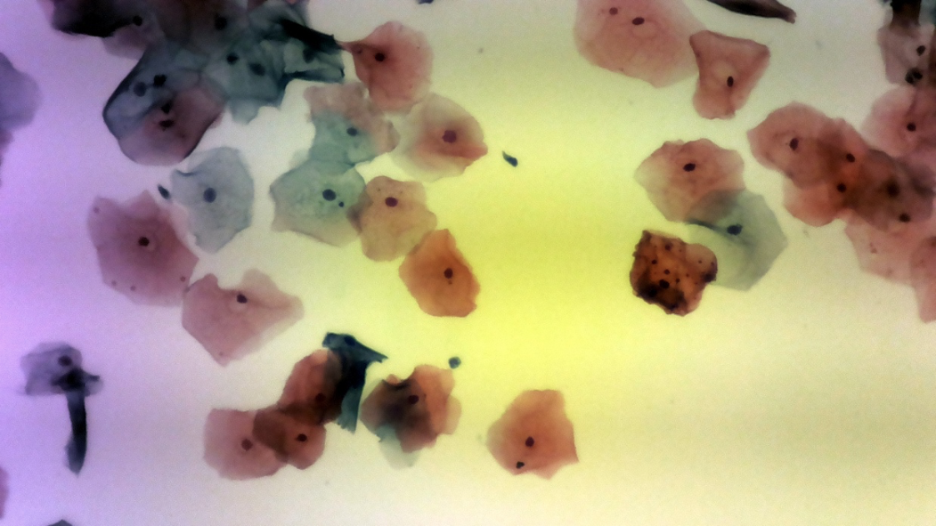 uterine cells viewed with a NHV-CAM microscope
